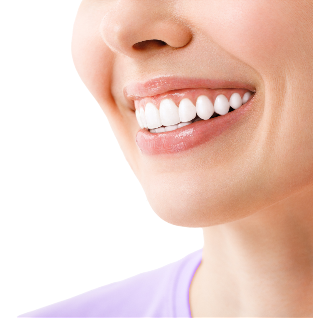 Как отбелить зубы всего за один час - wikiHow