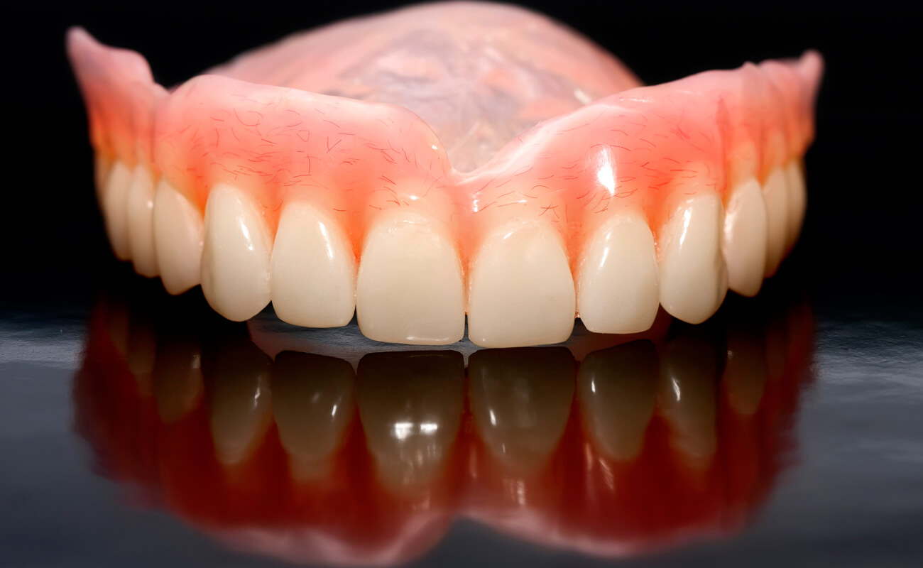 Протезирование верхней челюсти при отсутствии зубов
