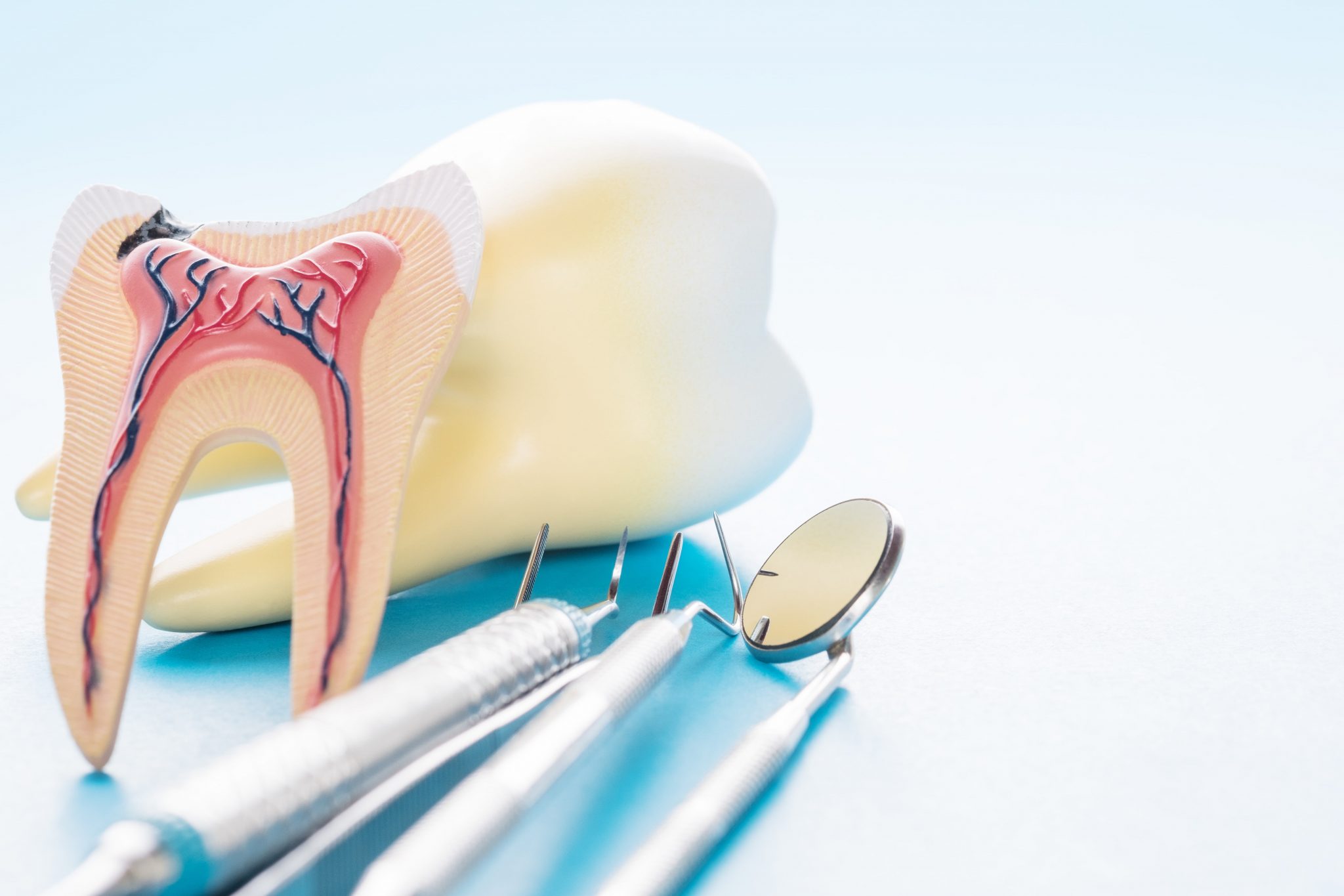 Болит зуб после удаления нерва, что делать?