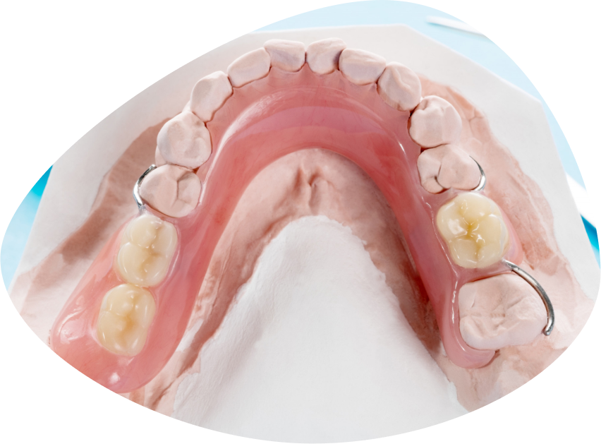 Как ухаживать за зубными протезами: поддерживаем чистоту и сохраняем долговечность