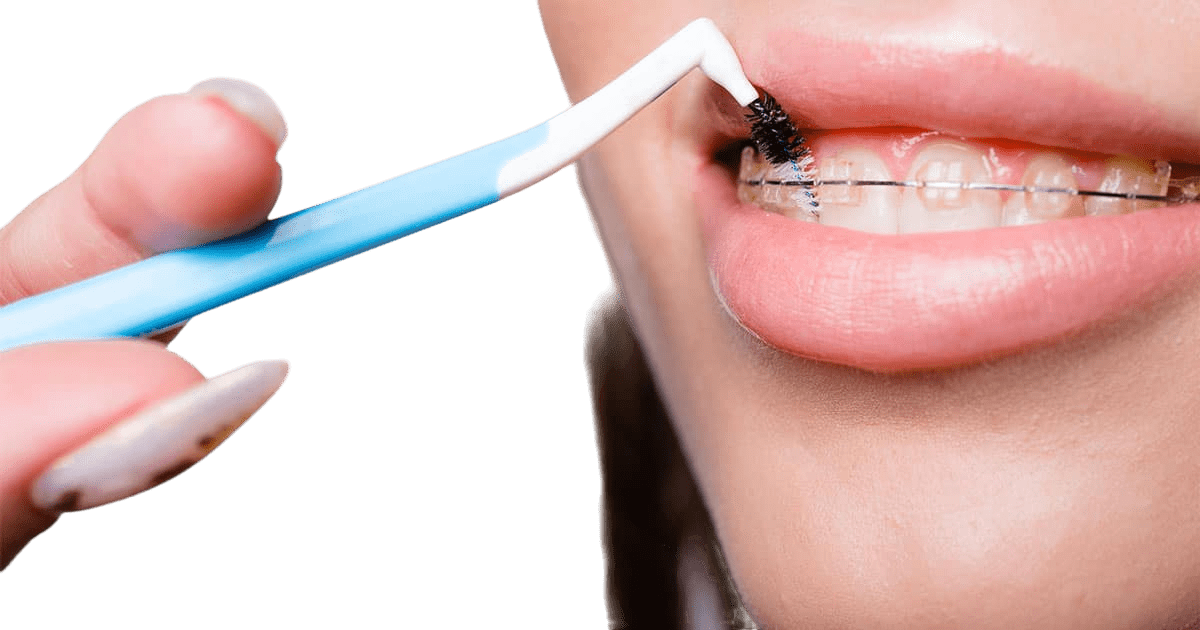 Ирригатор для зубов – что это и как его применять?