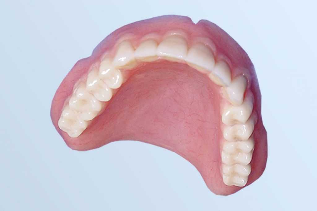 Протез на челюсть без зубов. Бюгельный протез на верхнюю челюсть. Съёмный бюгельный протез на верхнюю челюсть. Съемный протез (6-14 зубов) термо Джет. Экзостозы верхней челюсти.