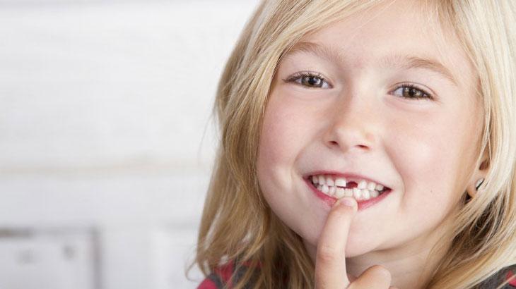 Что делать, если откололся зуб у ребенка