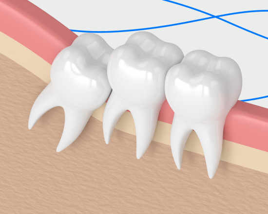 Удаление зуба при месячных